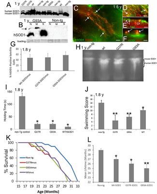 Skeletal Muscle-Restricted Expression of Human SOD1 in Transgenic Mice Causes a Fatal ALS-Like Syndrome